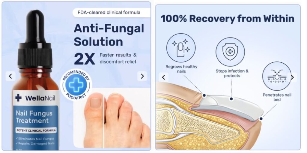 WellaNail Nail Fungus Treatment